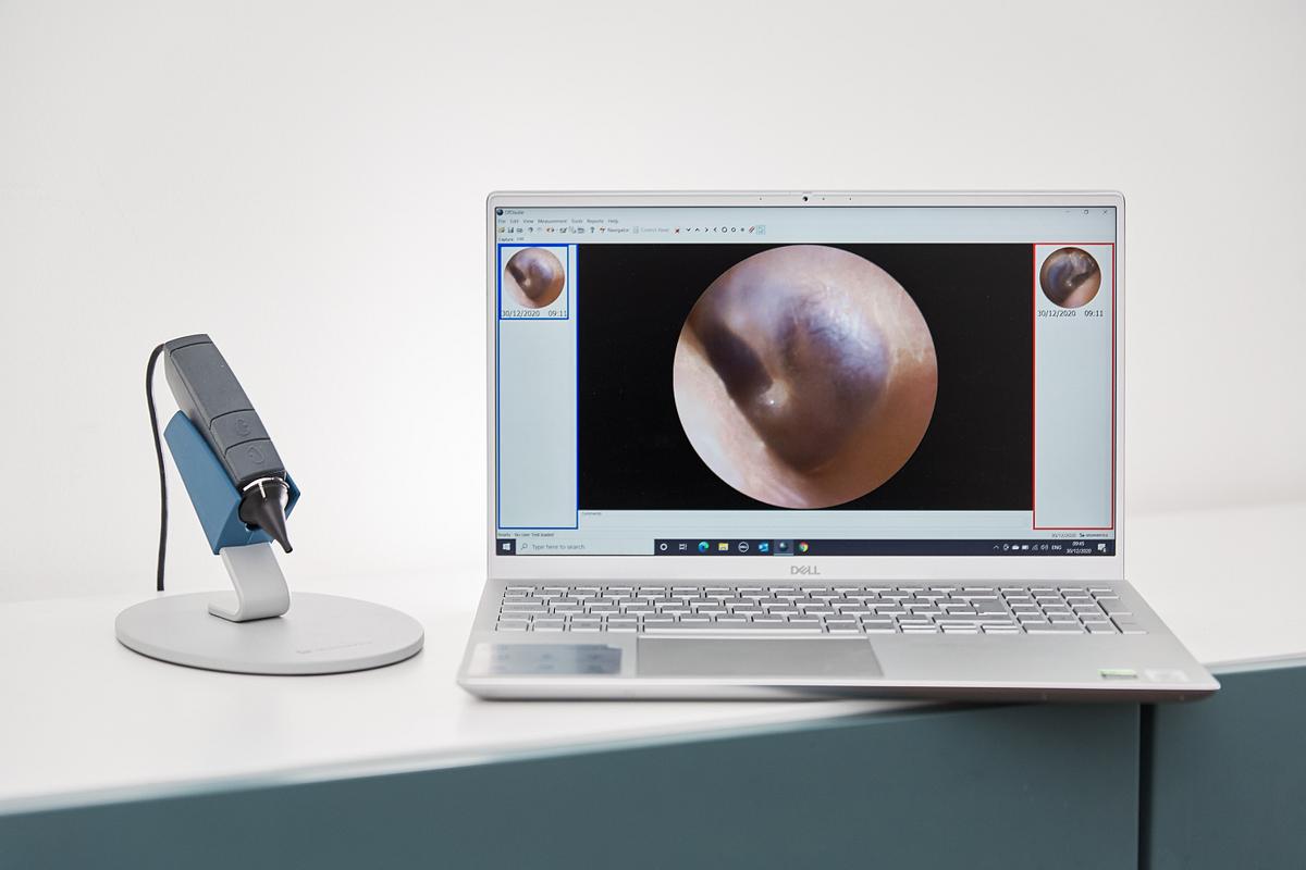 Ear Wax Removal Within The NHS News